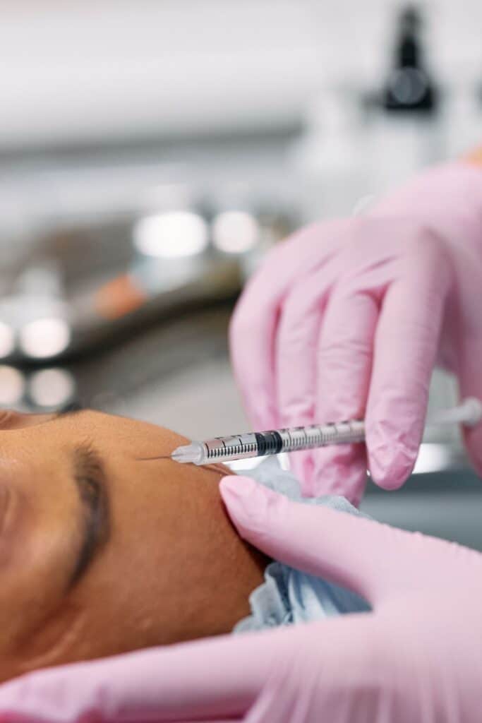 Botox i Panden og Læberne